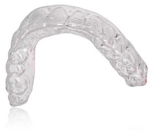 Aparelho_Esthetic_Aligner Aparelho_Esthetic_Aligner